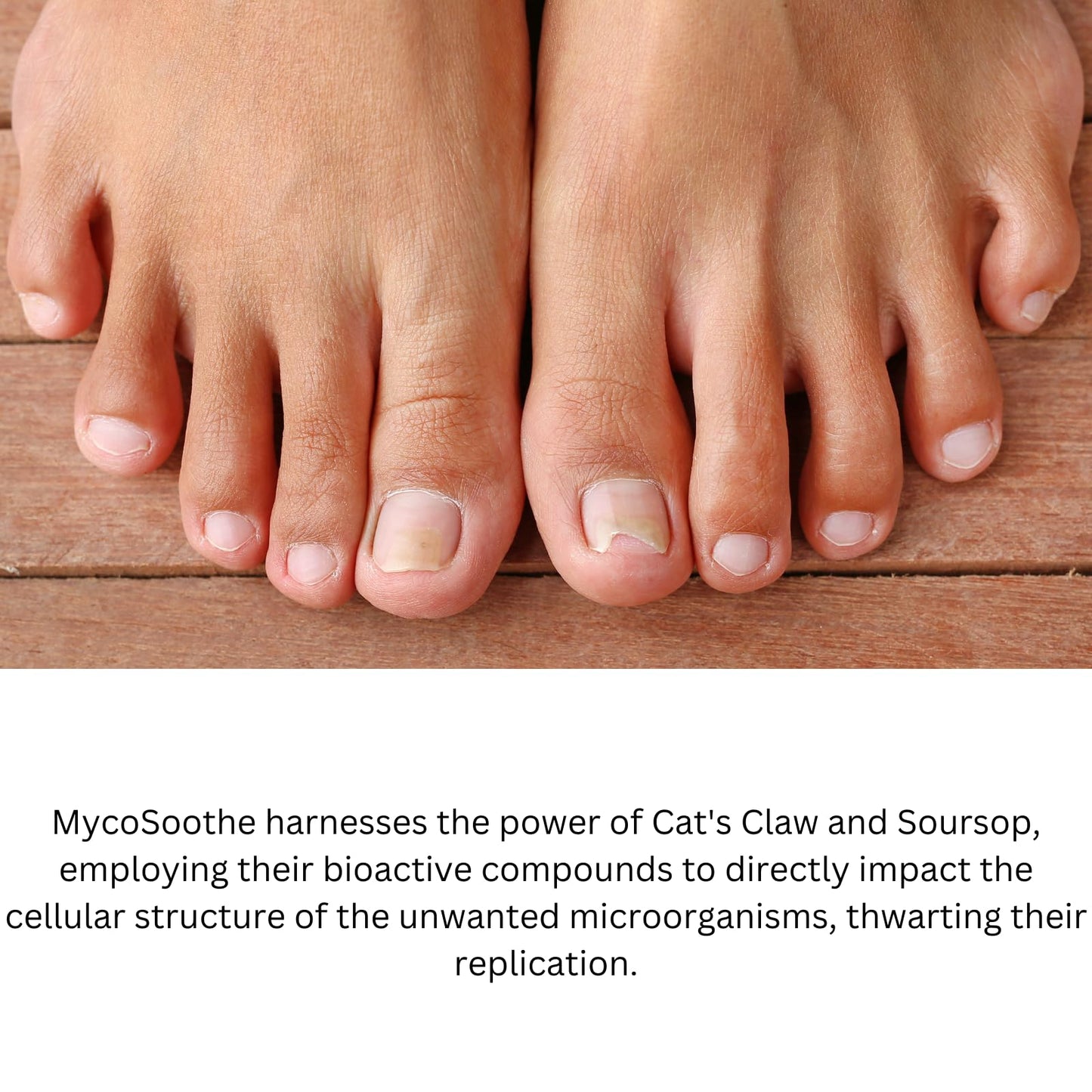 Phytage Labs MycoSoothe Advanced Hair, Skin, Nail & Immunity Support Formula 60 Capsules