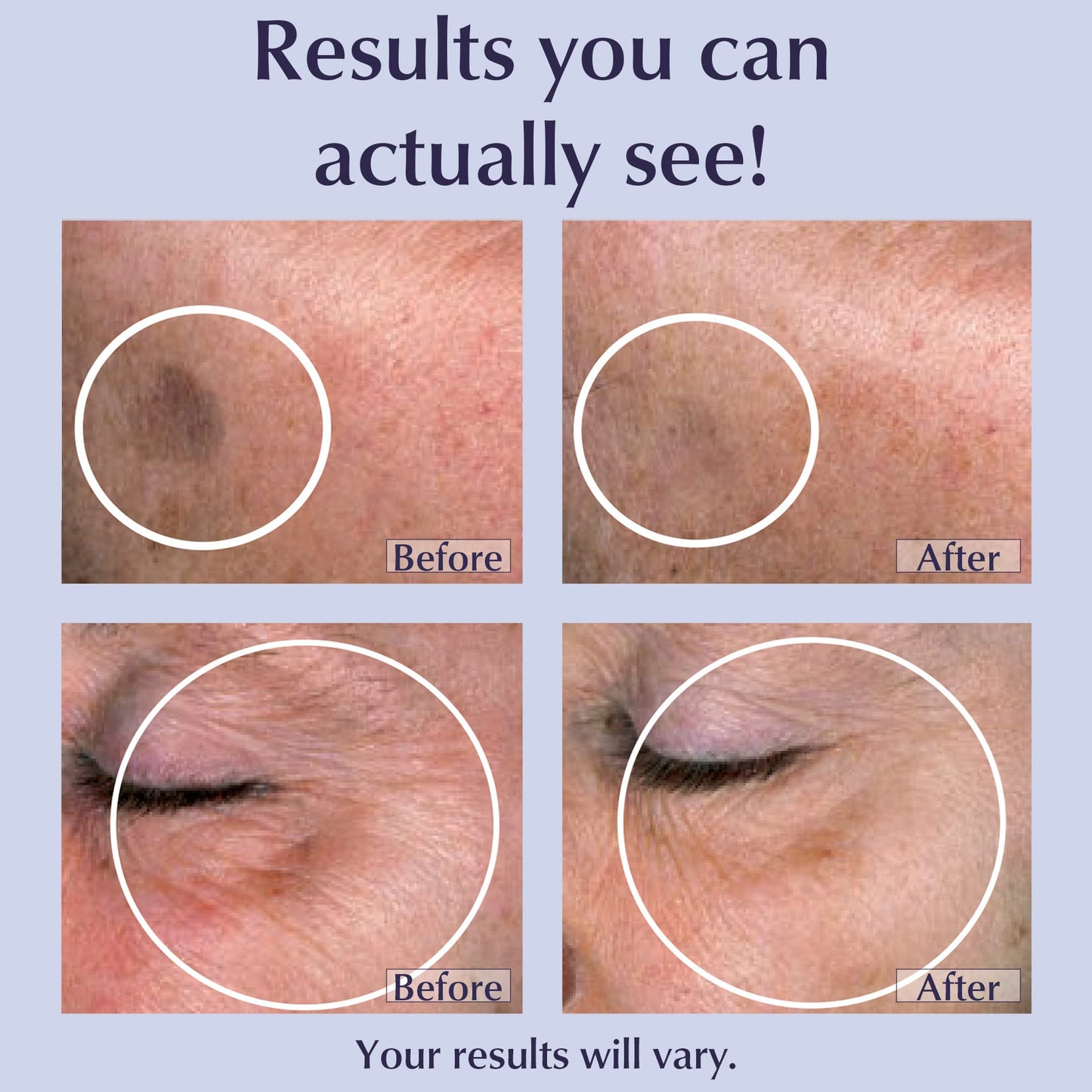 LANE LABS Toki Powder Collagen Supplement for Skin 180