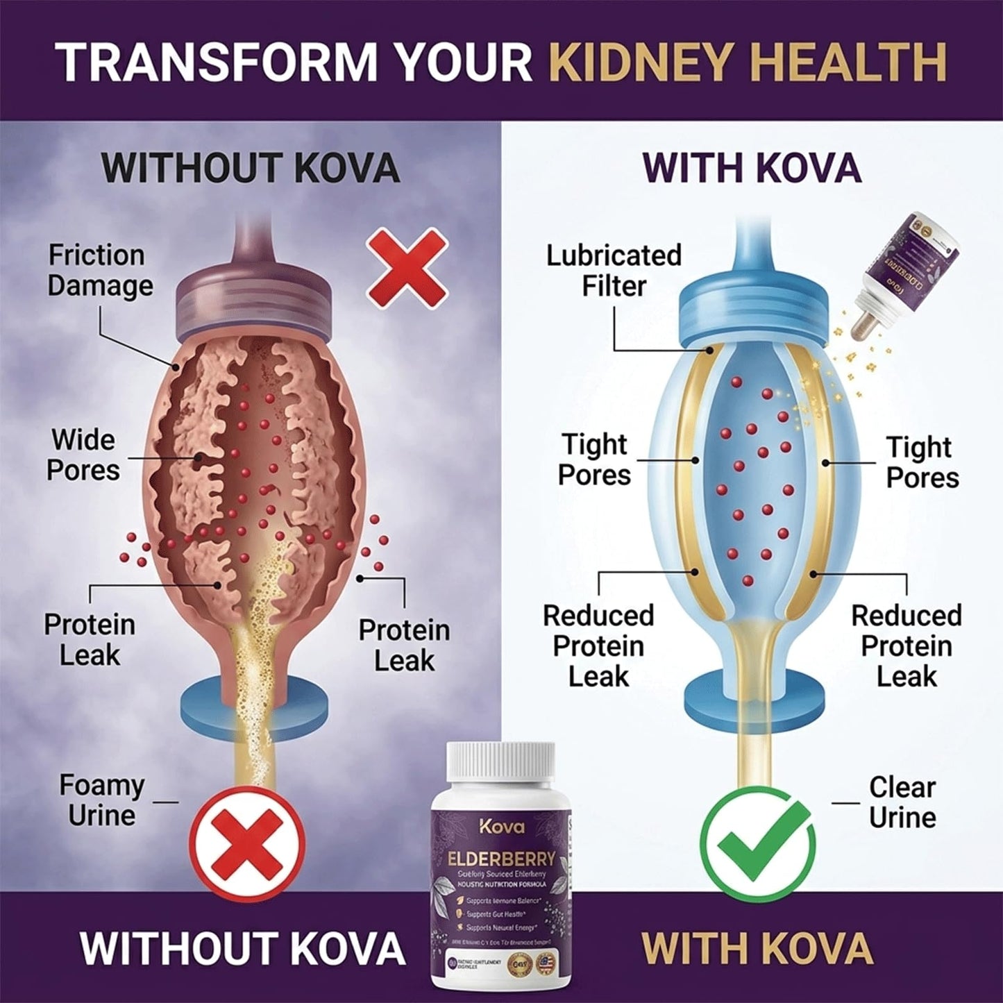 XRFOHCE Kova Elderberry Capsule 60 Count