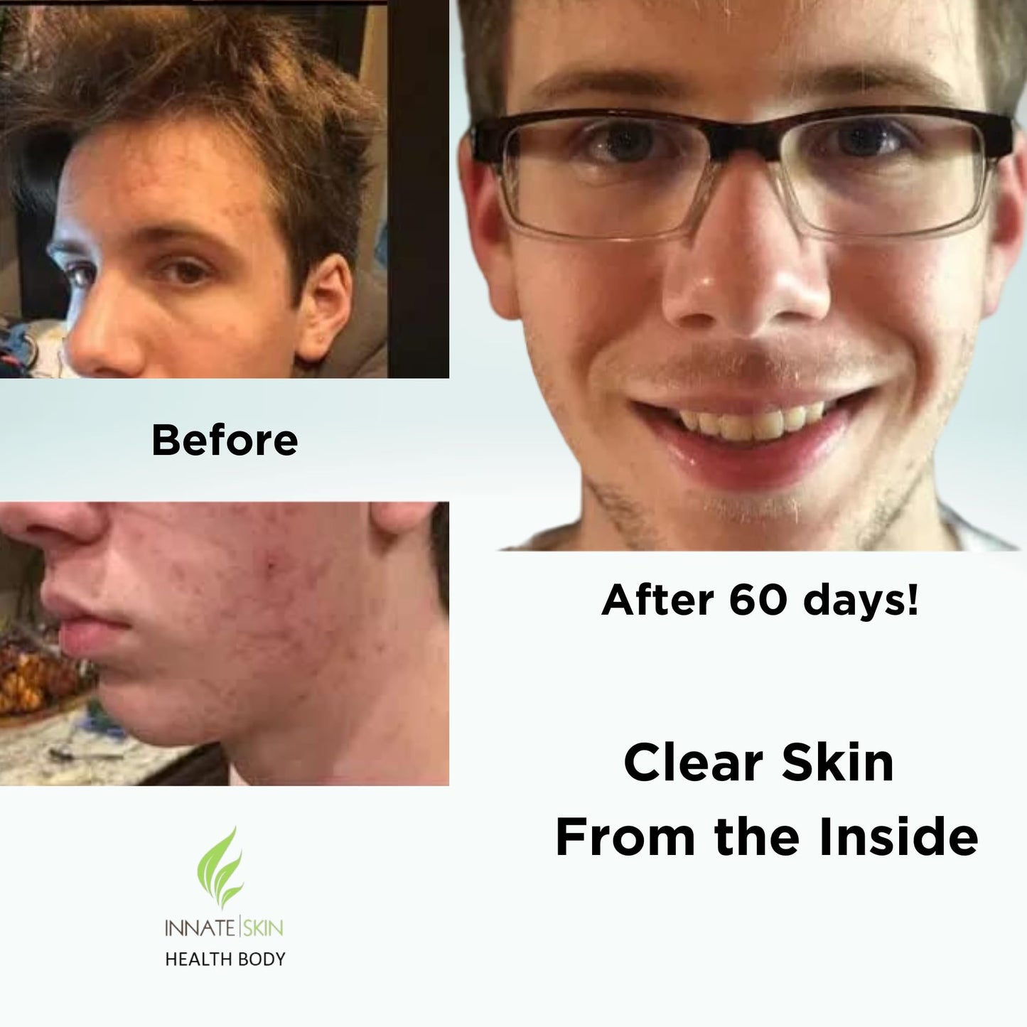 Innate Skin Clear Skin Acne Vitamin System Capsules 240 Total Capsules