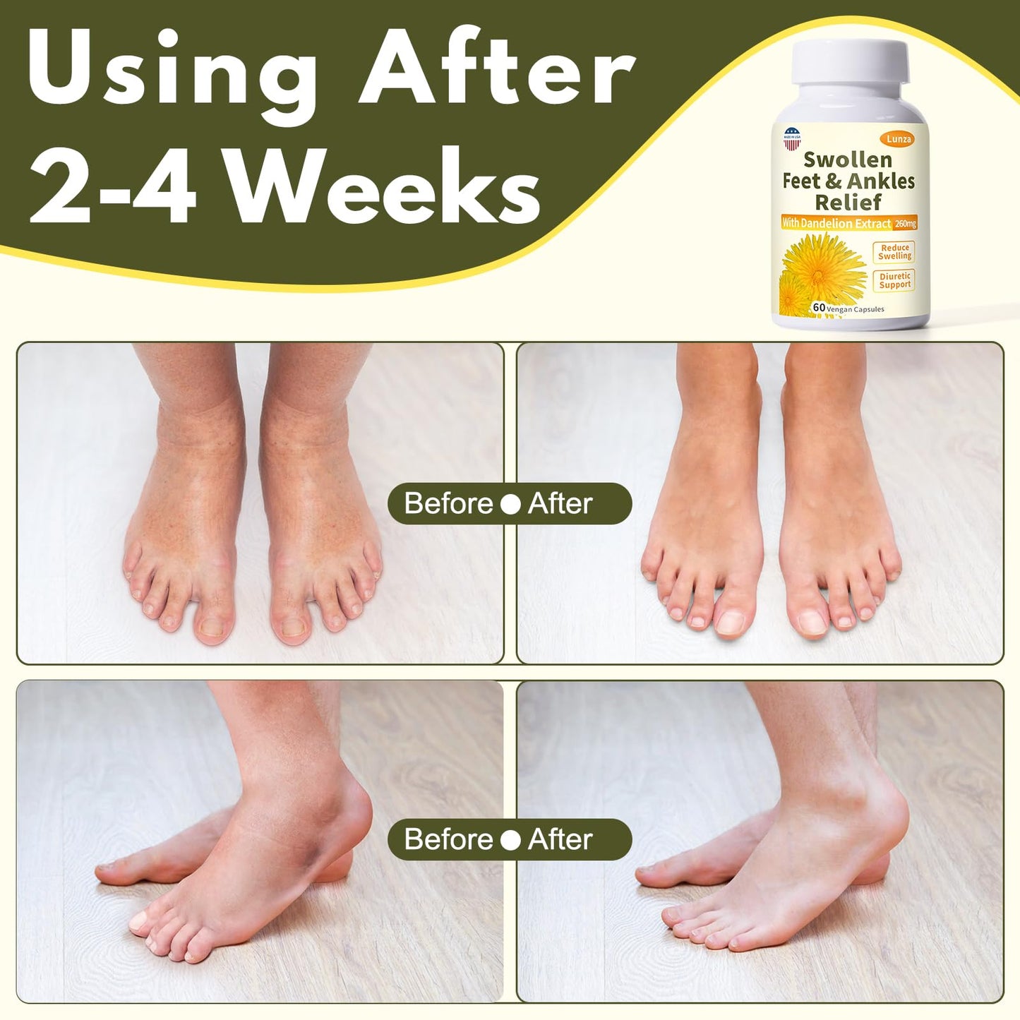 Netrca Swollen Feet and Ankles Relief with 260mg Dandelion, Edema Relief for Legs, Feet & Ankles, Water Retention, Fast-Acting Formula, Natural Ingredients, 120 Capsules