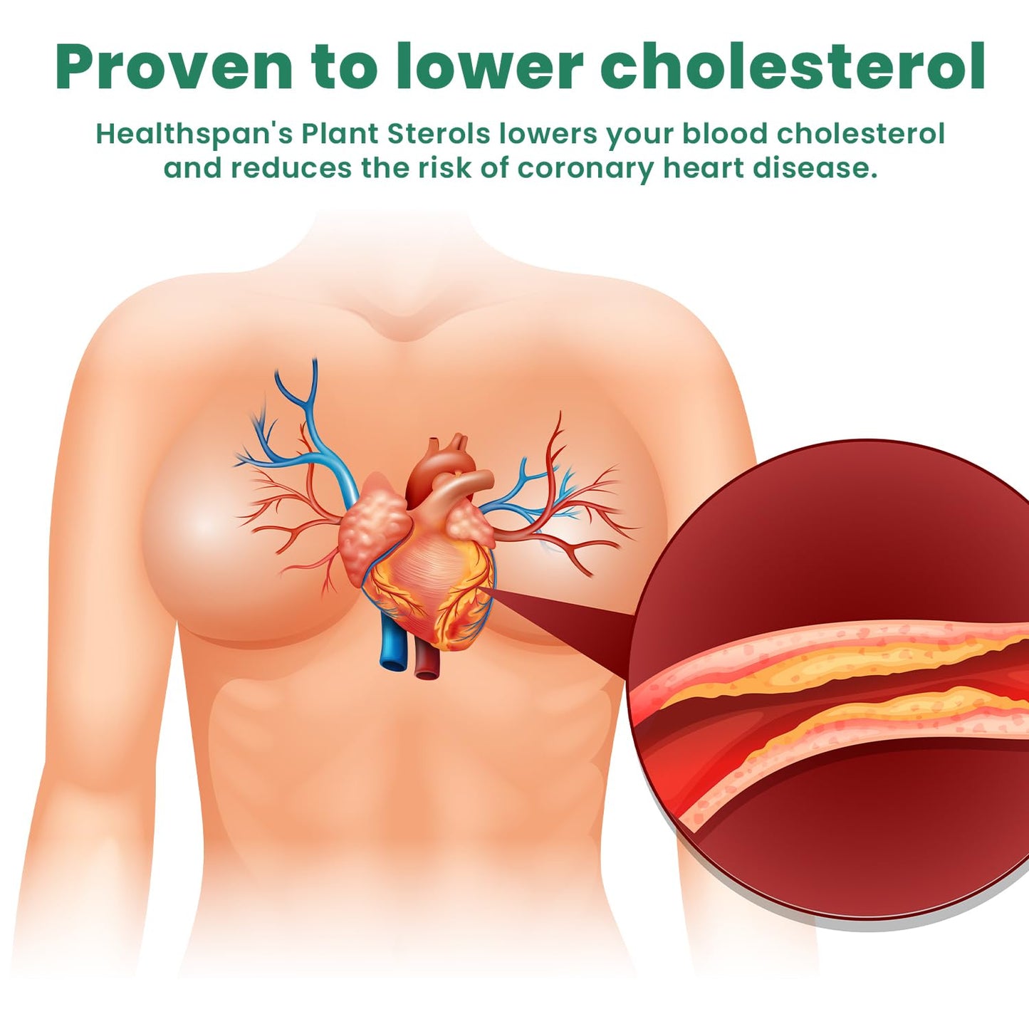 Ved Cholesterol Probiotics and Prebiotics Capsule, 10 Billion CFU, 20 Live Bacterial Cultures, Lactobacillus Helveticus, 28 Count