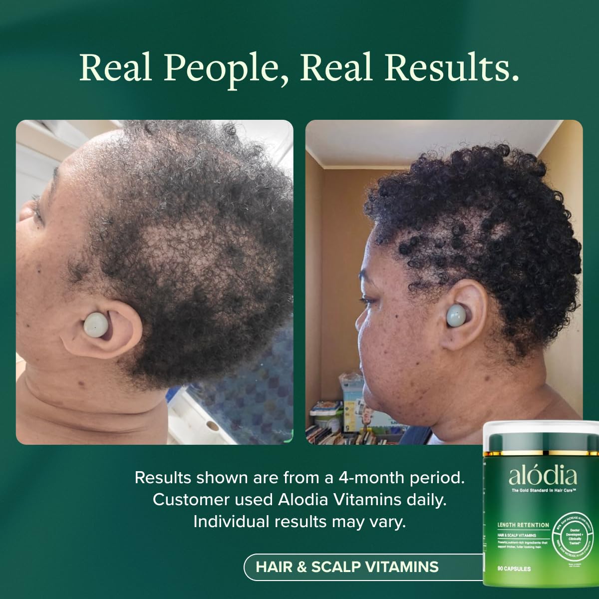 ALODIA Hair and Scalp Vitamins for Women 90 Capsules