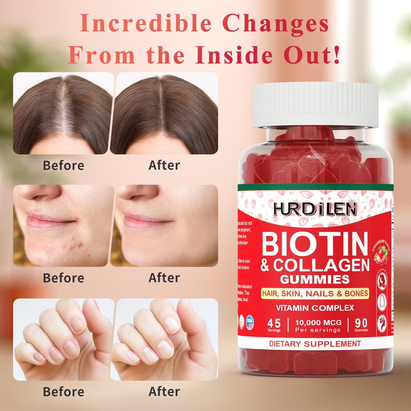 Hurdilen Hair Skin and Nails Gummies Biotin Collagen, 10000mcg, 90 Gummies