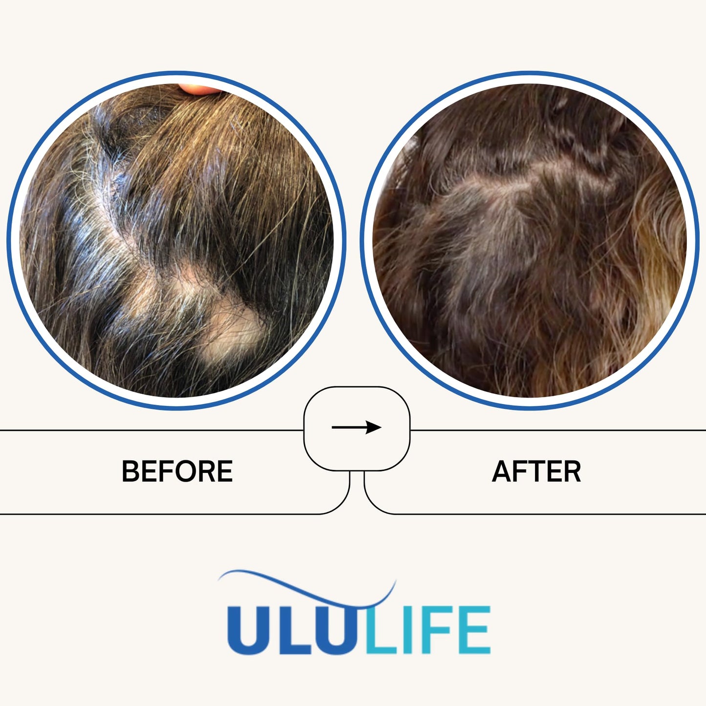 ULULIFE Ultimate Regrow Multivitamin Capsules, 180 Count