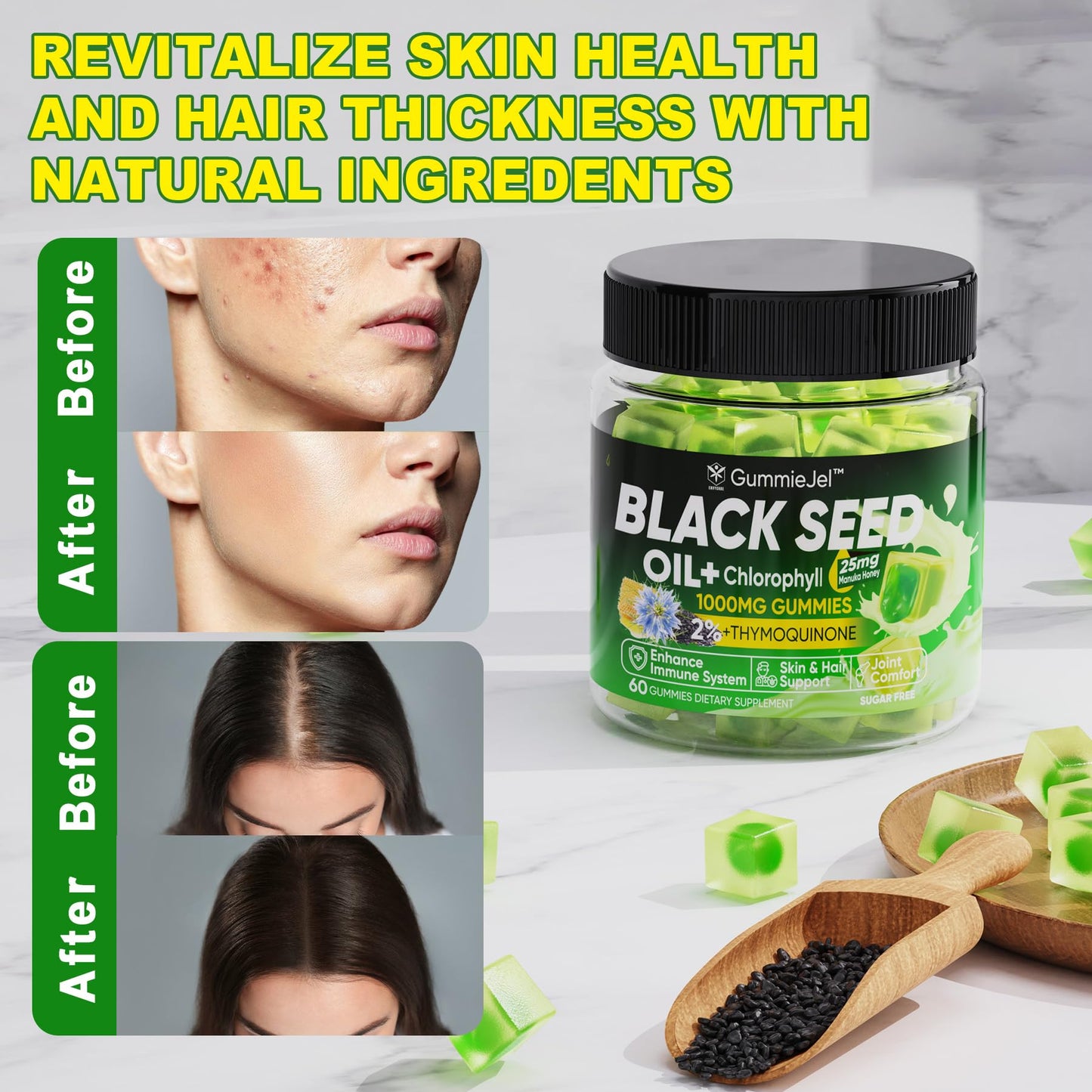 EnvyCure Black Seed Oil Gummies with Chlorophyll, Biotin 500mcg, Hydrolyzed Collagen, Raw Manuka Honey, Organic Cold Pressed - Ultimate Absorption for Skin, Hair & Nails, Digestive, Overall Health, 60 Gummies