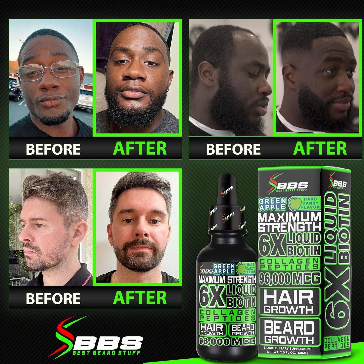 BBS Best Beard Stuff Beard Growth Kit Gummies with Biotin & Vitamins, 27 Count