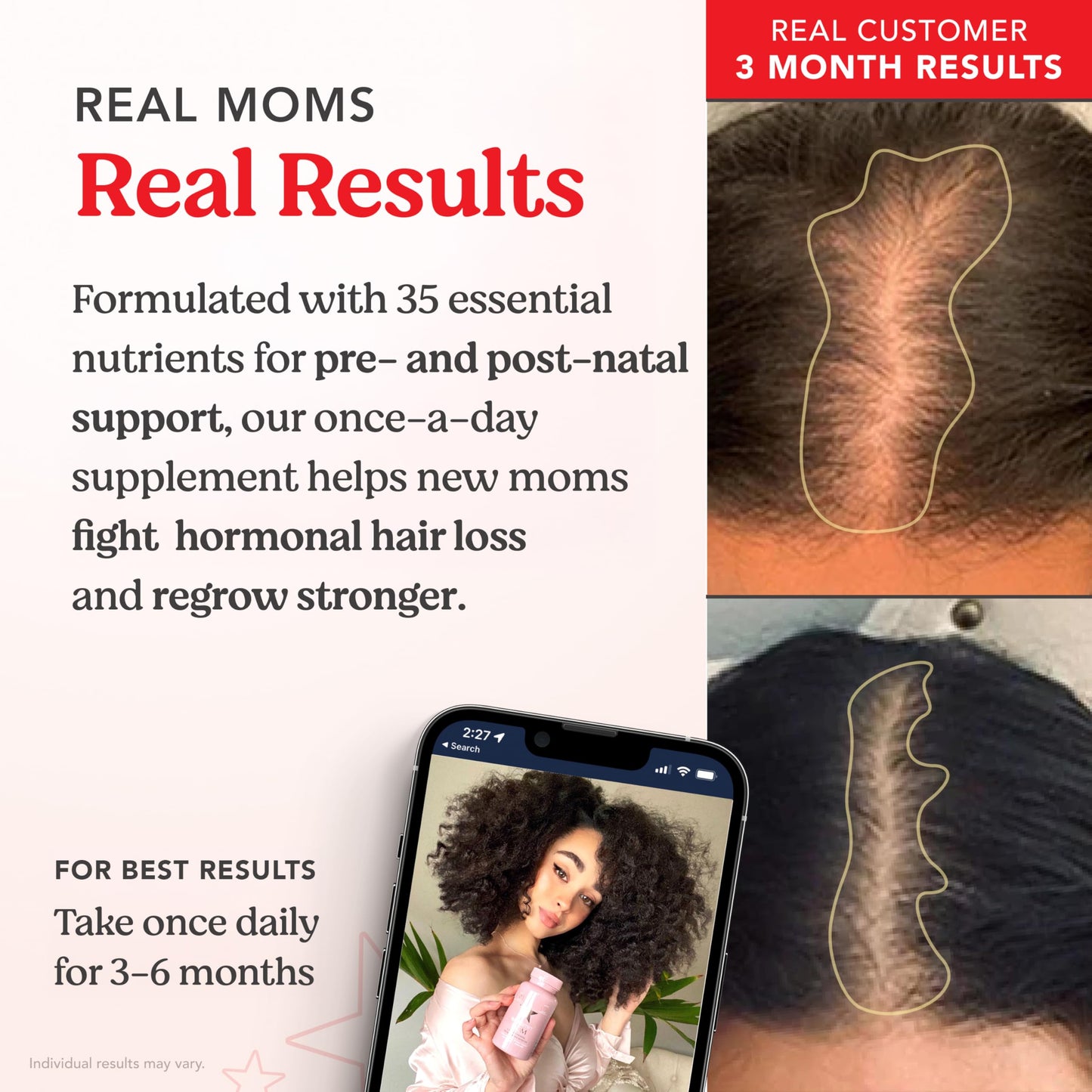 HAIRtamin MOM Prenatal & Postnatal Hair Vitamins Capsule 90 Count