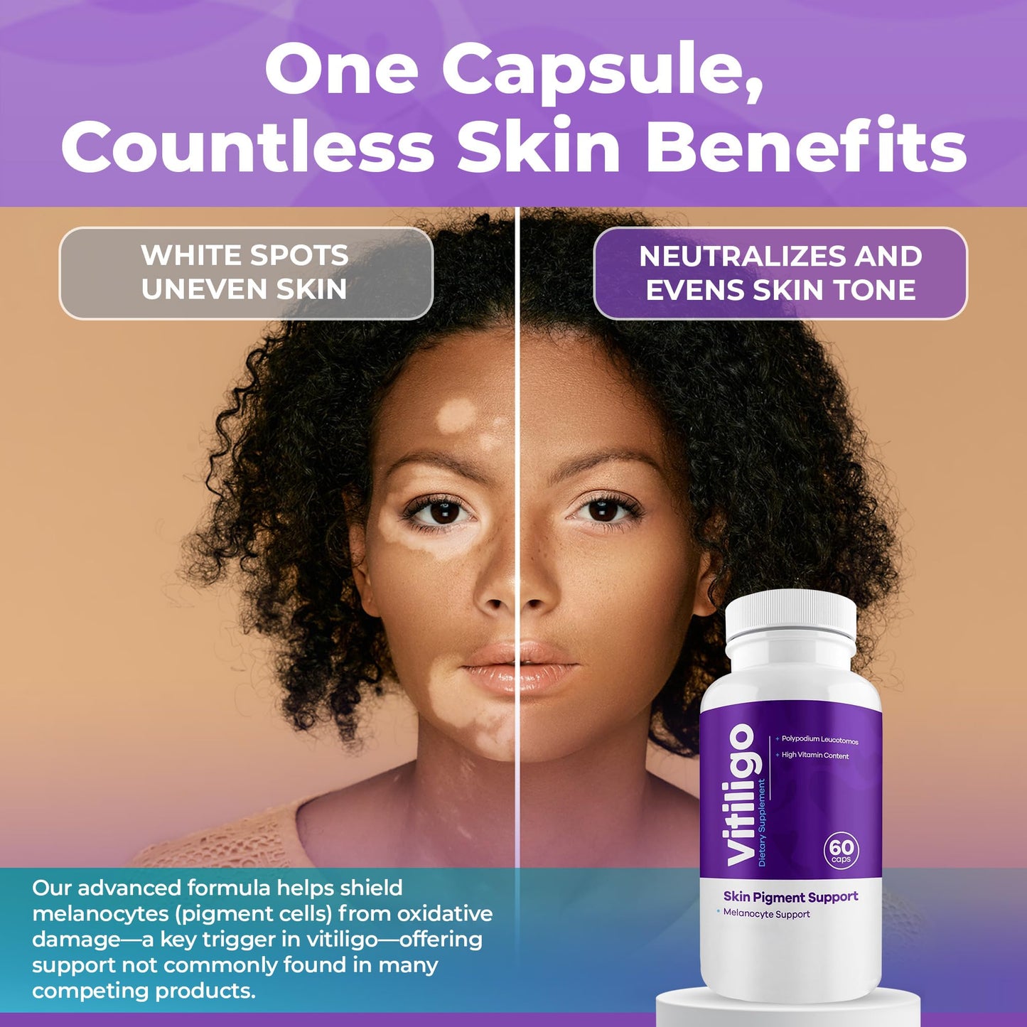 AURA VITAMINS Vitiligo Capsules 180 Count