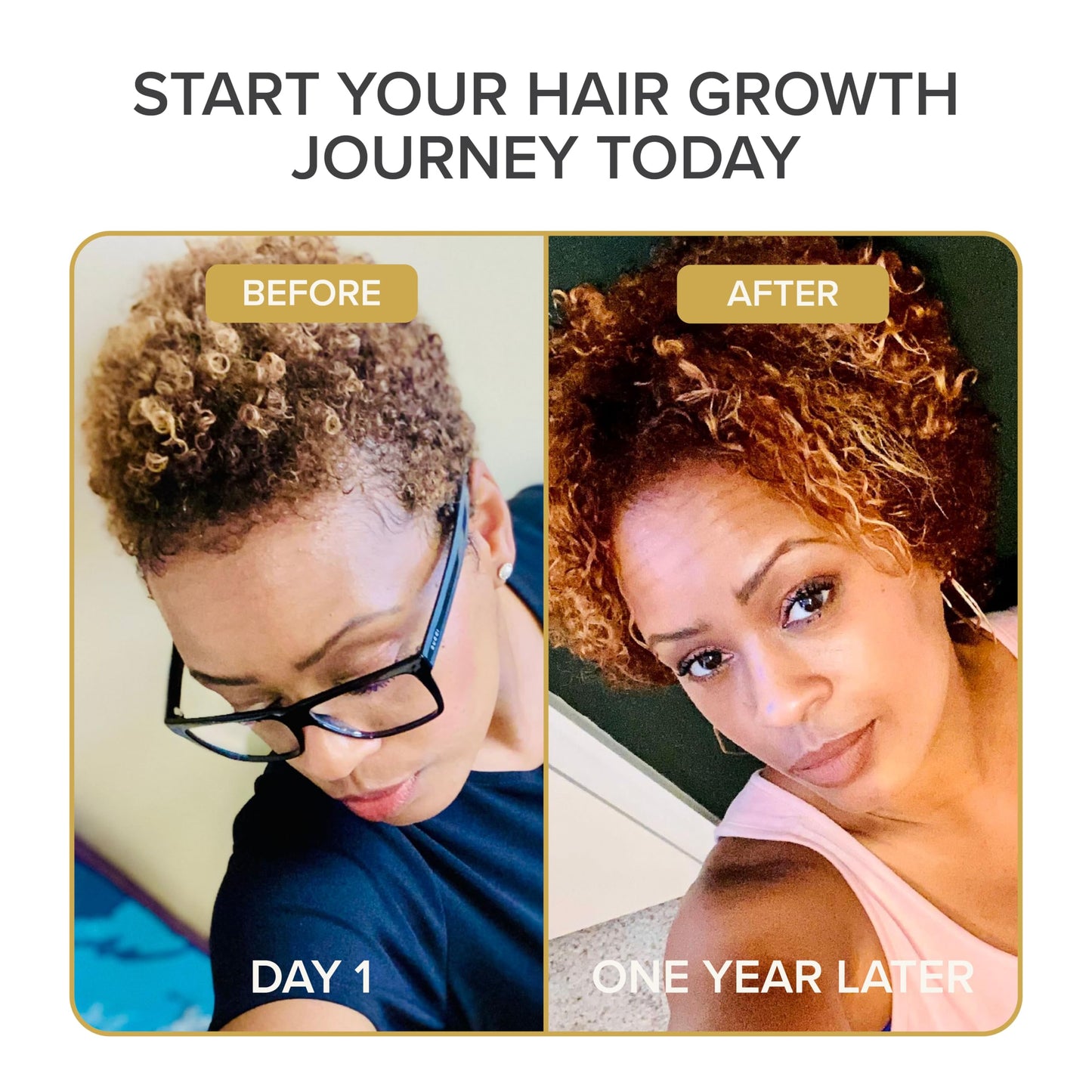 Shedavi Iconic Natural Hair Vitamins for Fast Hair Growth 60 Capsules