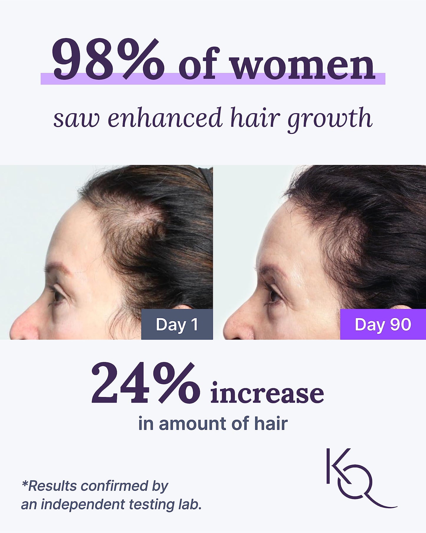Keranique KeraViatin Hair & Scalp Health Supplement Softgel 120