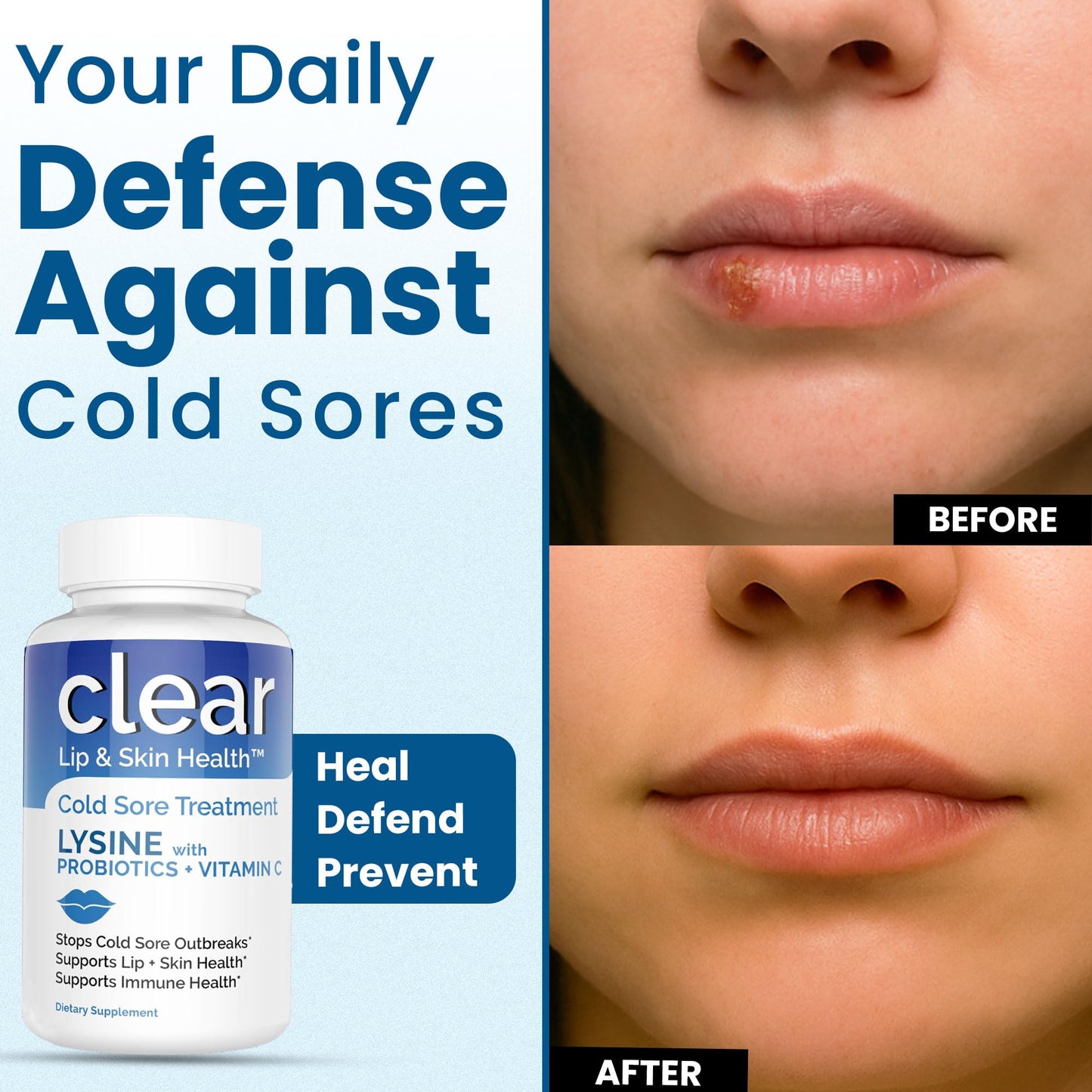 Clear Probiotics Lysine Cold Sore Treatment for Lips with Pre-Probiotics & Vitamin C 180 Capsules
