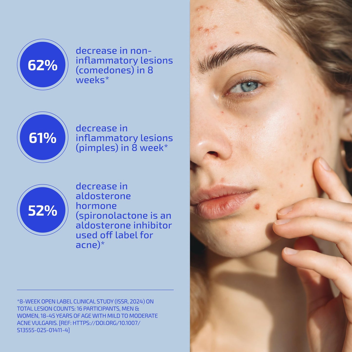 Codex Labs Shaant Skin De-Stress Supplement for Women 30 Softgels