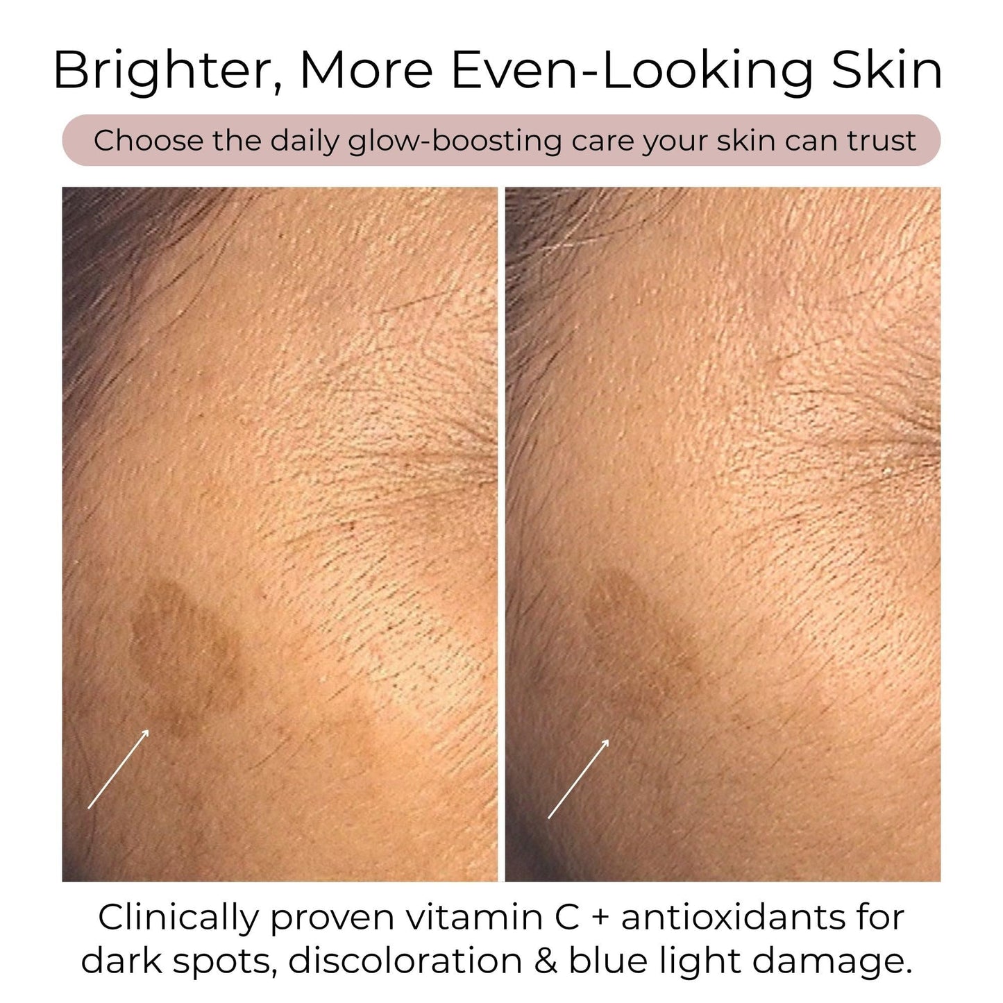 Hush & Hush Vitamin C Supplement for Skin Brightening Powder, 60