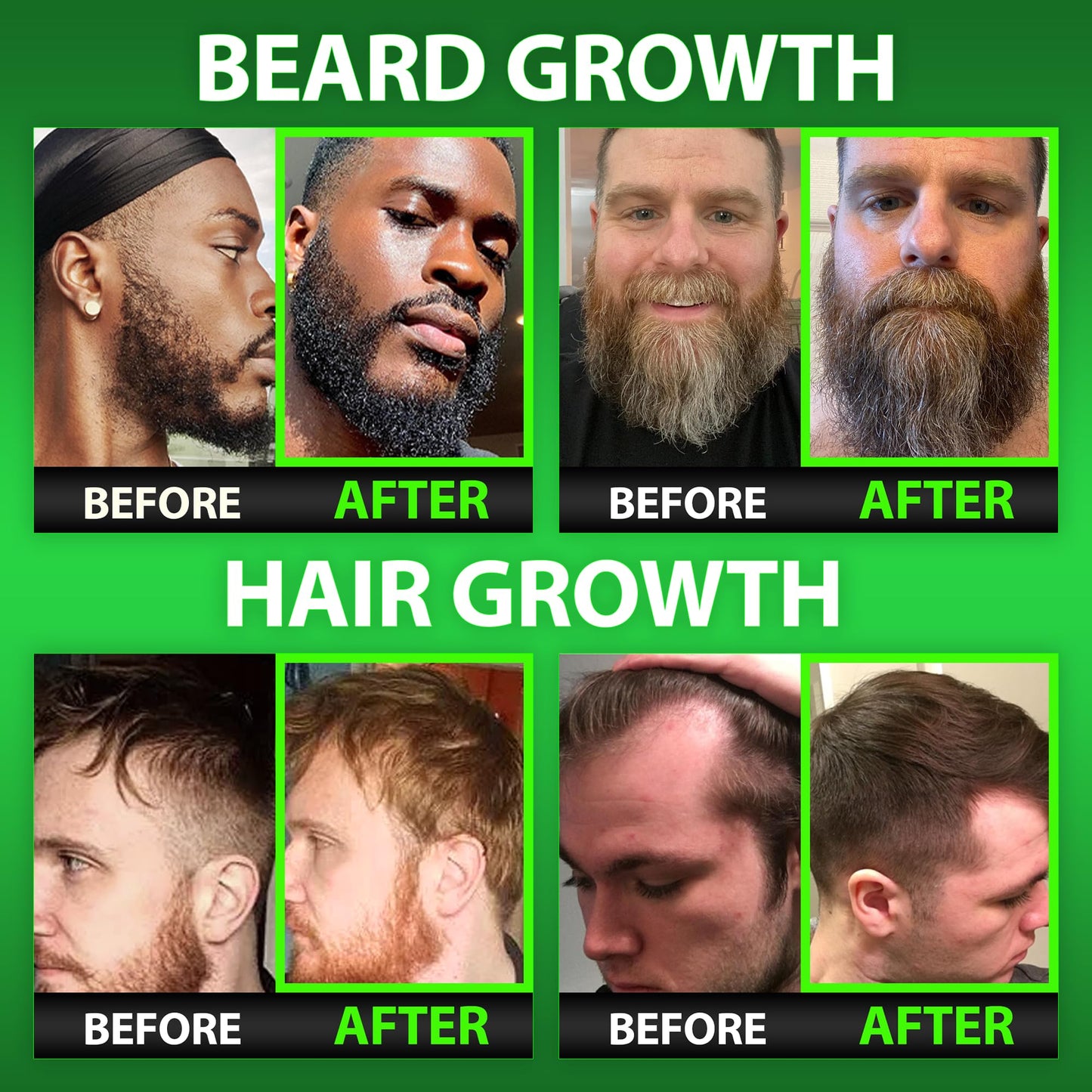 BBS Best Beard Stuff Beard Growth Kit Gummies with Biotin & Vitamins, 27 Count