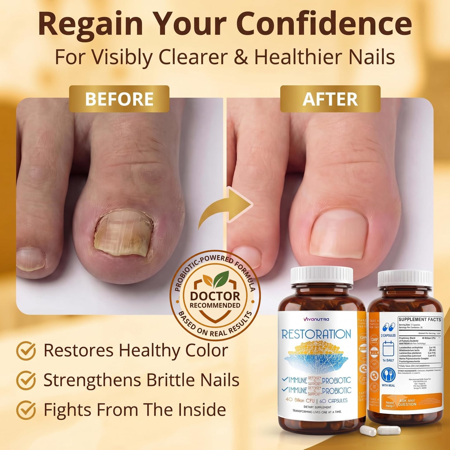 VIVANUTRA Restoration Probiotic Nail Fungus Supplement Extra Strength Capsules 60 Count