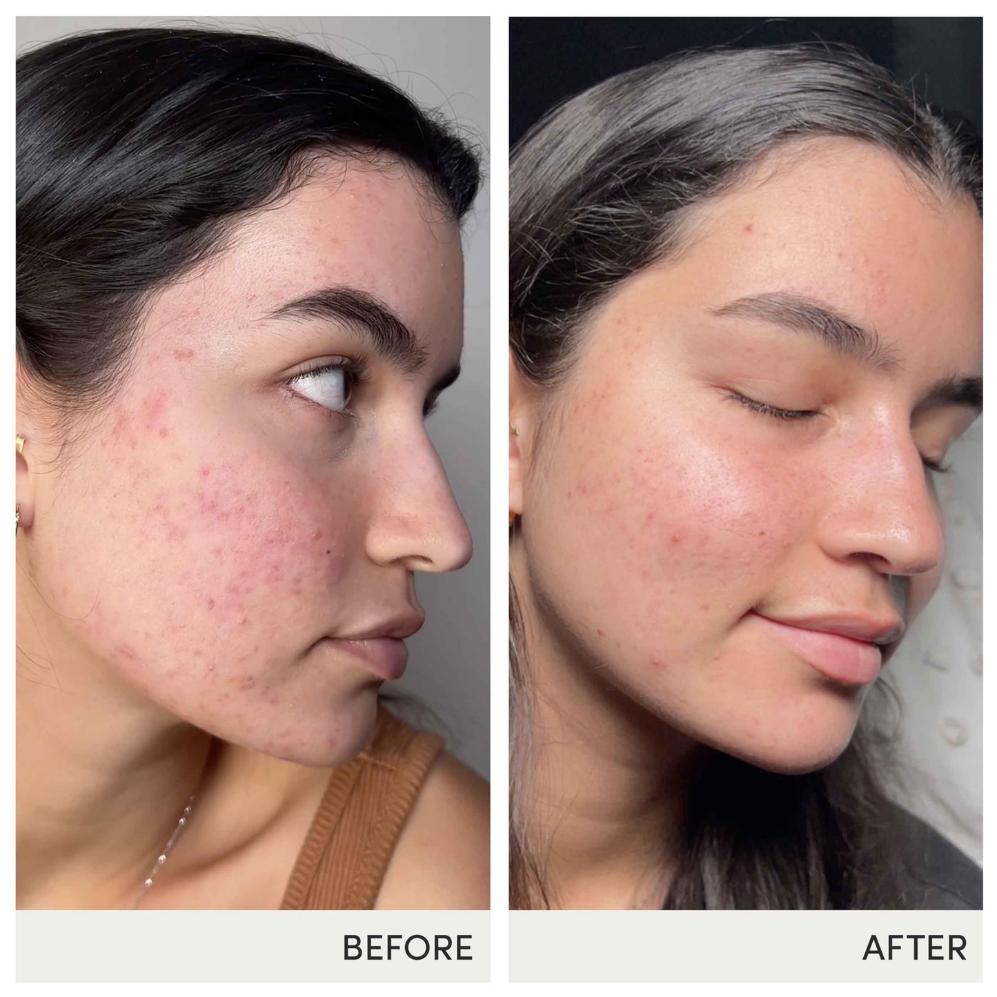 Jane Iredale Advanced Nutrition Programme Skin Accumax Supplement Capsules 180