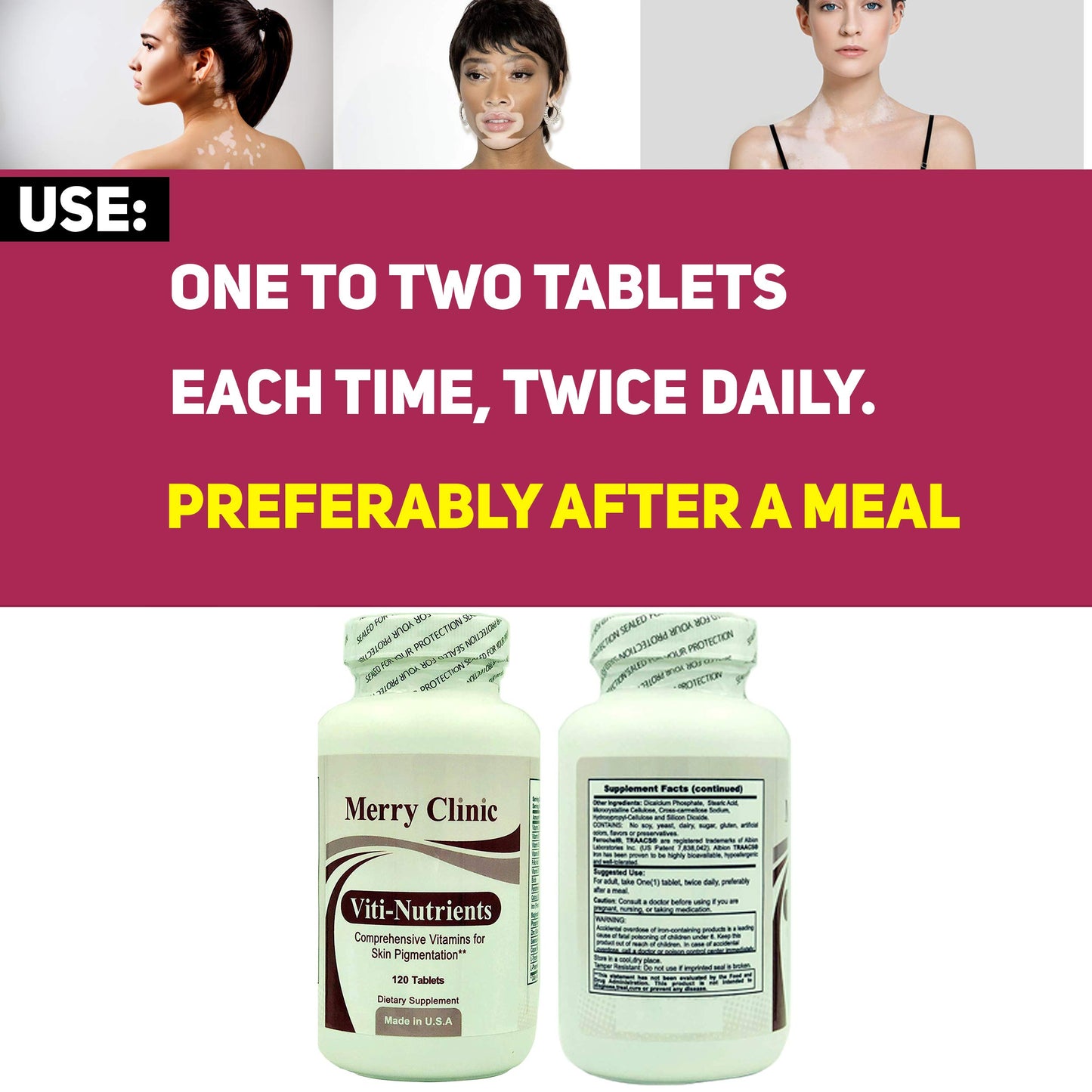Merry Clinic Viti-Nutrients Comprehensive Vitamins for Skin Pigmentation, 120 Tablets