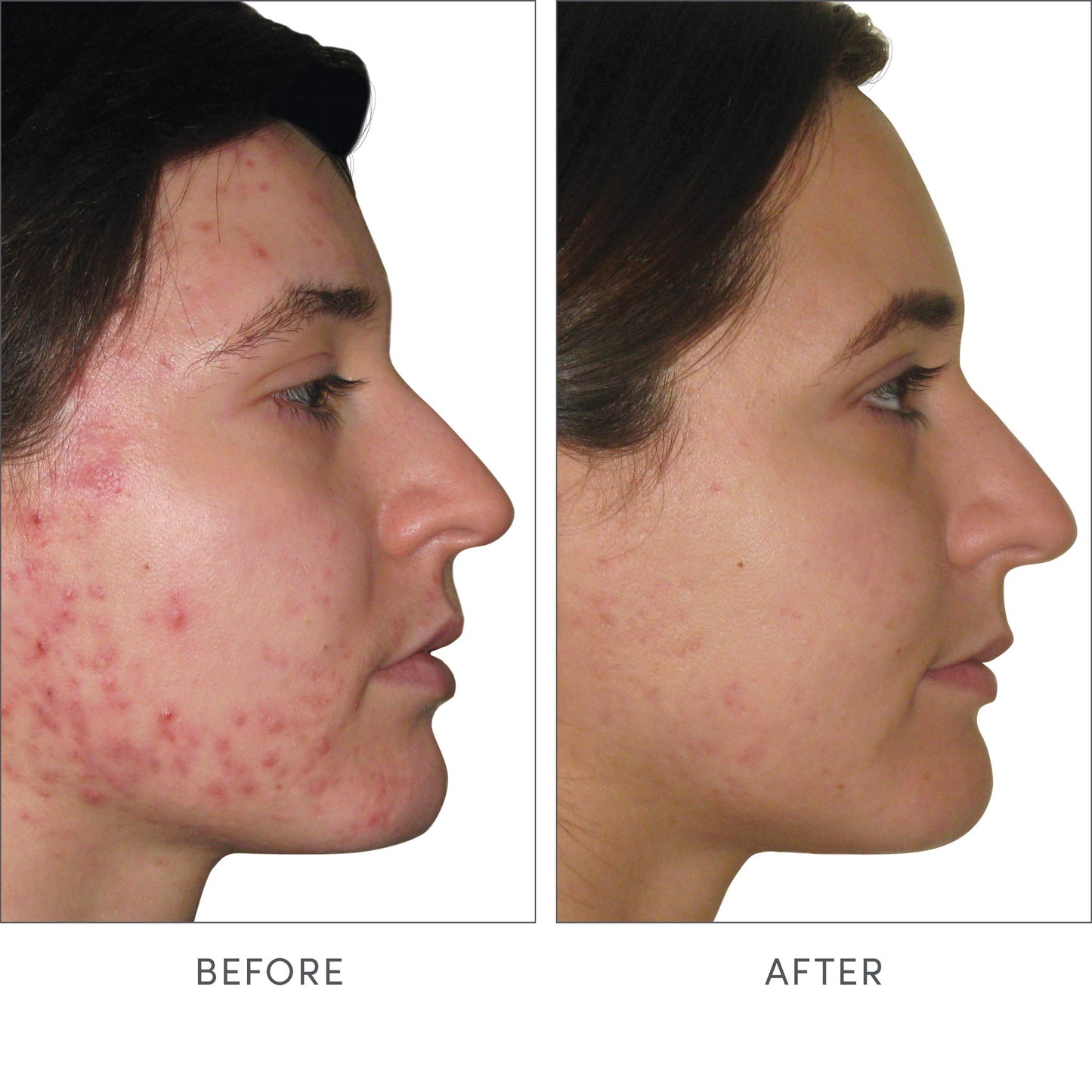 Jane Iredale Skin Accumax Capsule 8