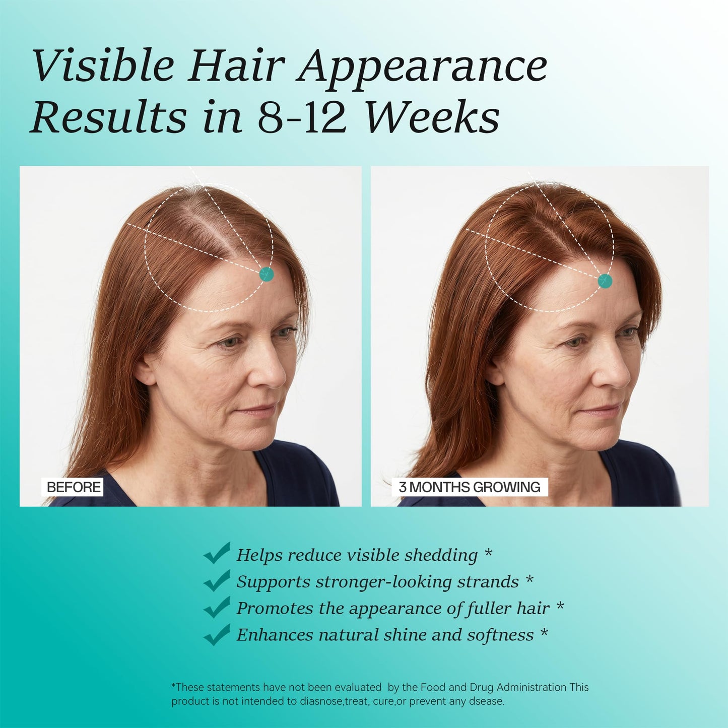 Wiltormin Hair Growth Supplements for Women, Ages 30 and Up - Clinically Tested for Visibly Thicker Hair with Biotin 10,000mcg, Vitamins, Keratin, Collagen, Saw Palmetto, Supports Scalp, Skin & Nails, 120 Capsules