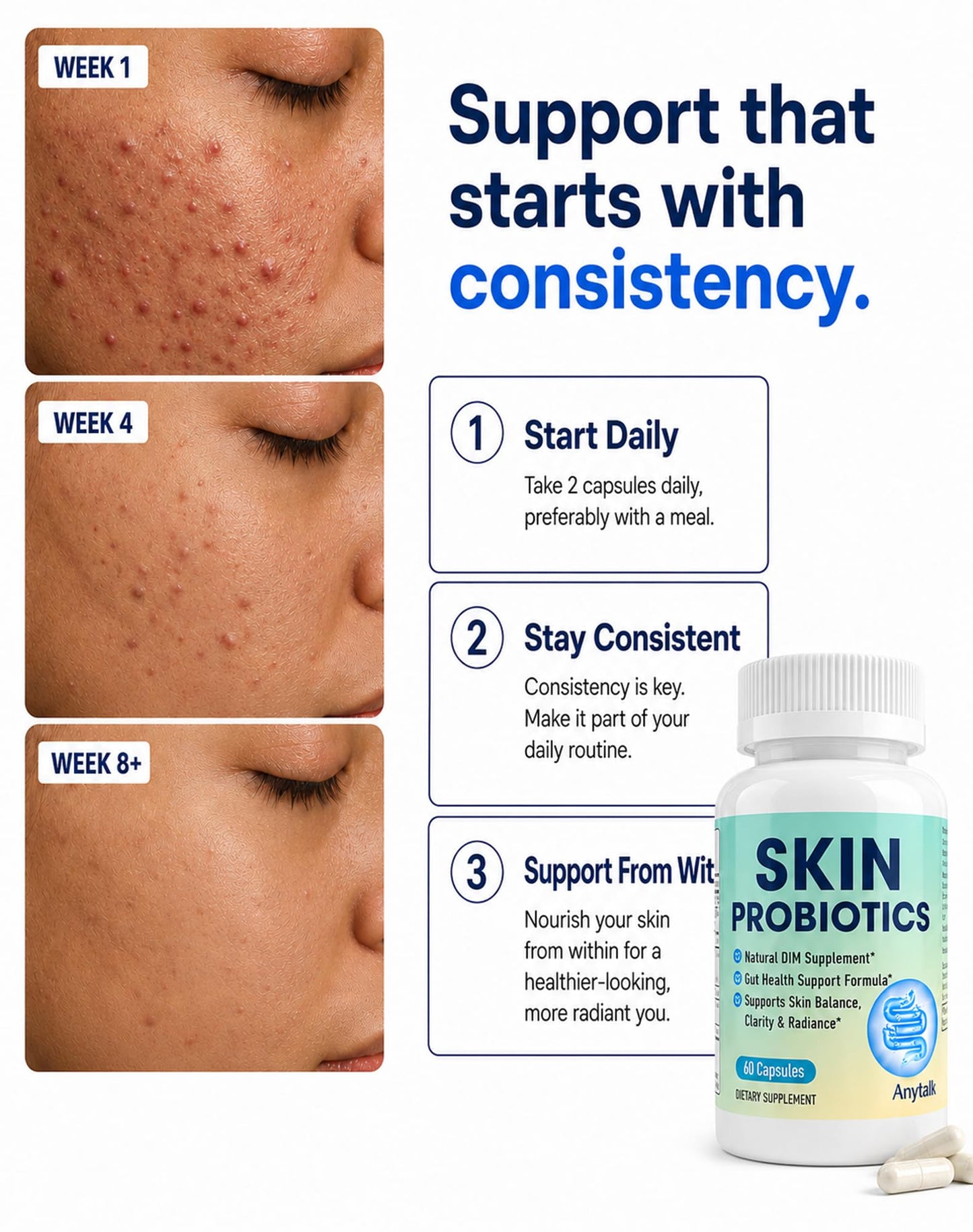 ANYTALK Skin Probiotic Supplement for Women & Men Capsule, 60 Count