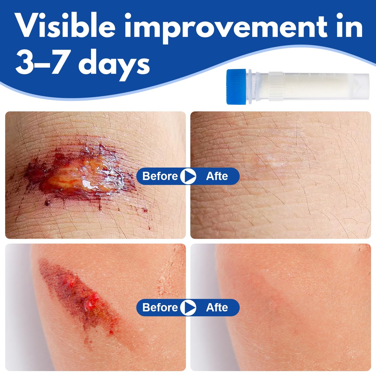 Poxo Collagen Powder for Wounds, 7 Tubes x 1g