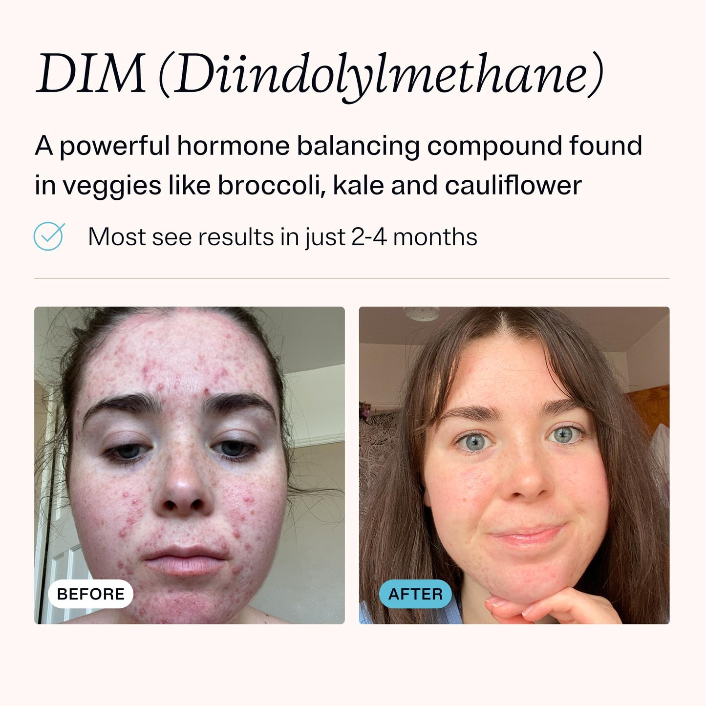 MDacne DIM Skin Clearing Supplements Capsules 30 Count