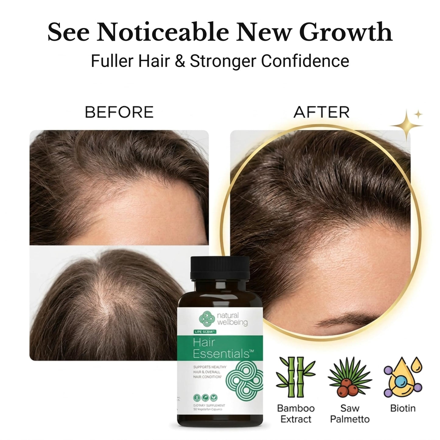 Natural Wellbeing Hair Essentials DHT Blocker Hair Growth Supplement for Women & Men – Saw Palmetto, Biotin – Vegan Capsules – Stops Shedding & Thinning, 90 Capsules