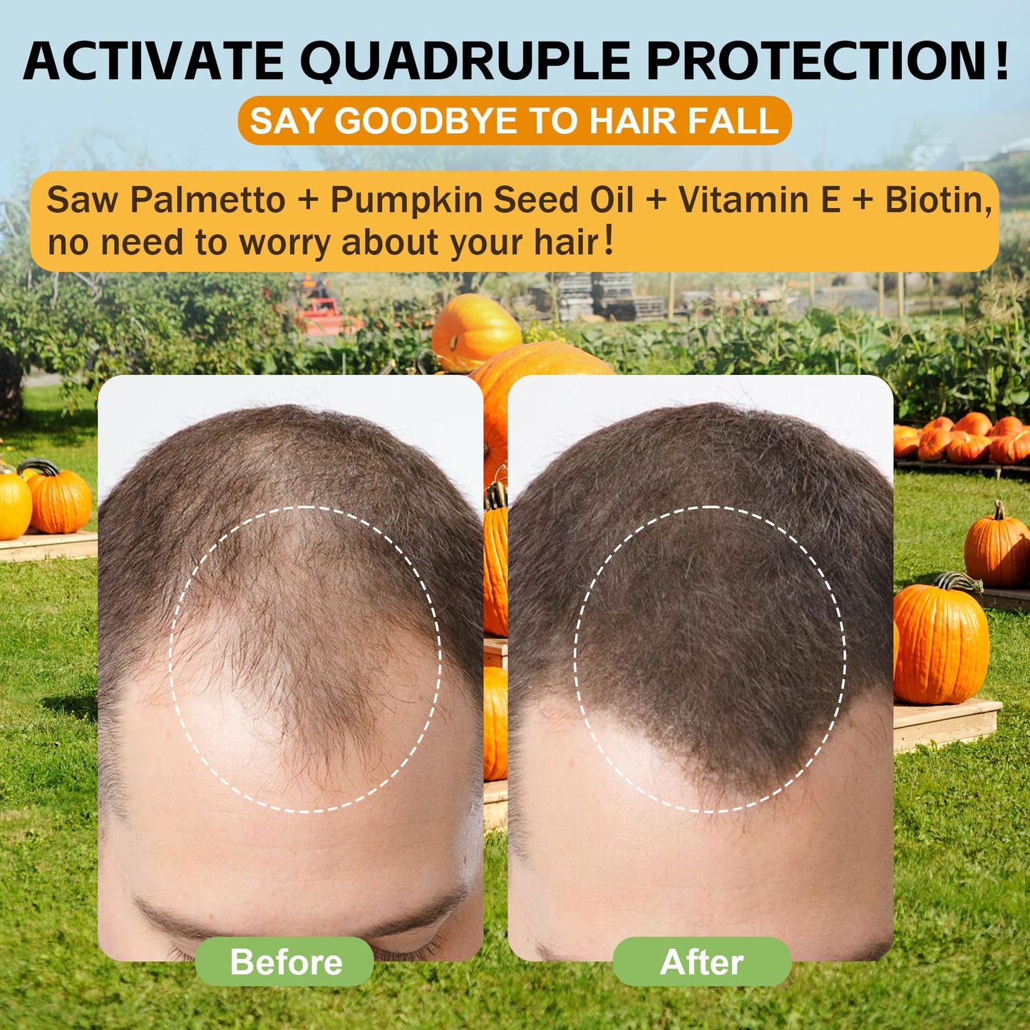 Well&Whole Pumpkin Seed Oil Gummies with Saw Palmetto for Hair Growth, for Men and Women, Vegan, Sugar-Free, 60 Count