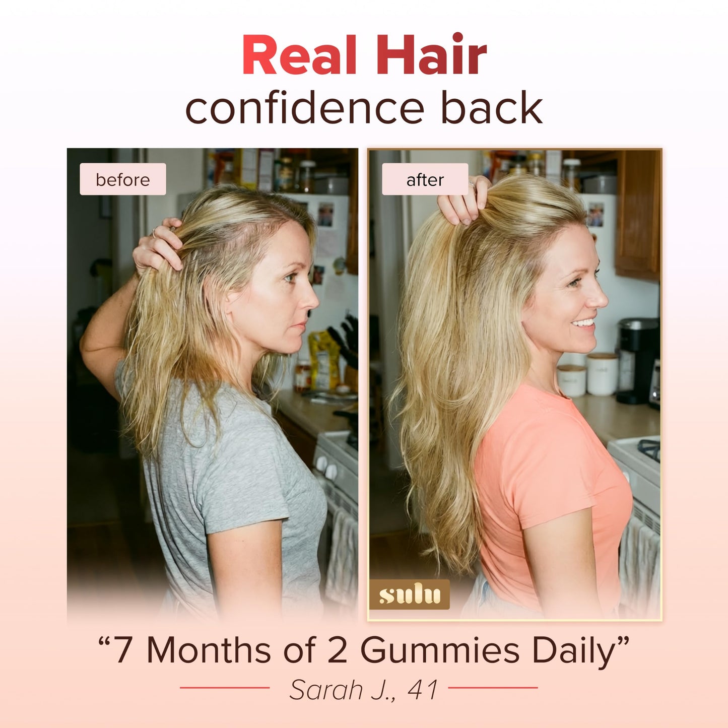 SULU Hair Growth Gummies Biotin Supplements for Women Skin Nails Vitamins, 60 Count