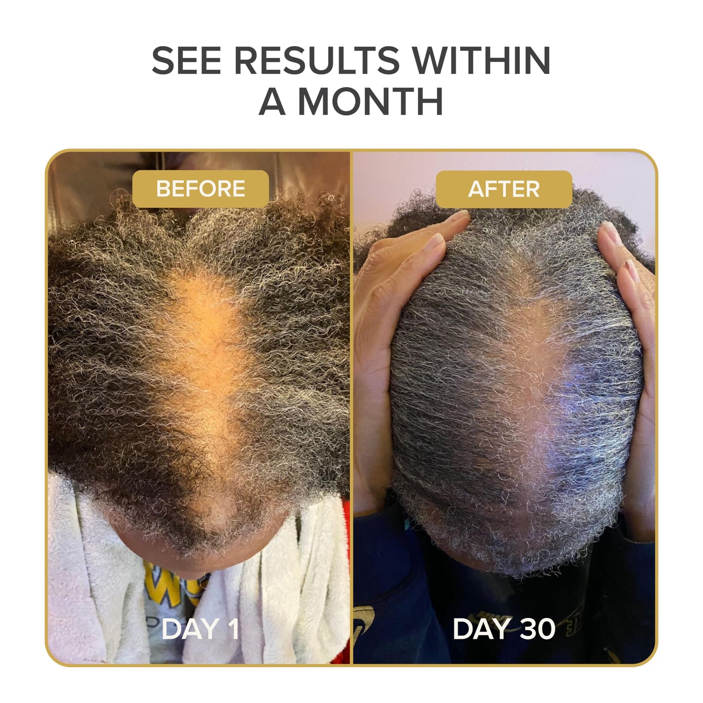 Shedavi Iconic Natural Hair Vitamins for Fast Hair Growth 60 Capsules
